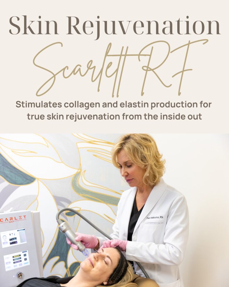 SkinPen Microneedling in Lexington